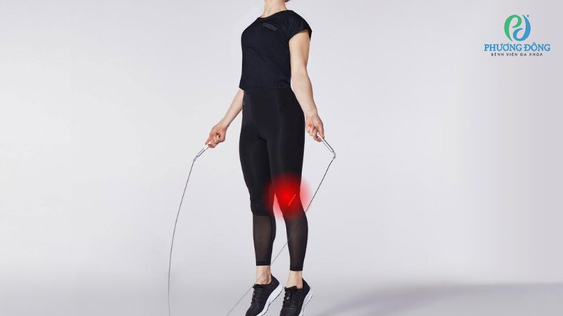 Bệnh nhân thoát vị đĩa đệm nên hạn chế hoặc ngừng tập nhảy dây