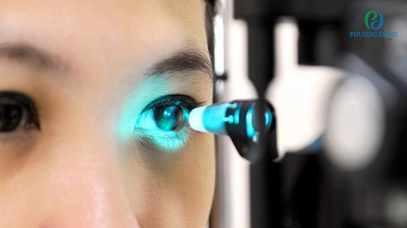 Bác sĩ nhãn khoa giải đáp: Cận 8 độ mổ mắt được không?