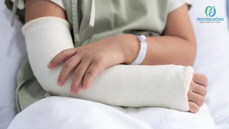 Gặp gỡ bác sĩ: Gãy xương tay có quan hệ được không? Gặp gỡ bác sĩ: Gãy xương tay có quan hệ được không?
