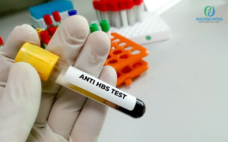 Xét nghiệm anti HBs là gì? Khi nào cần thực hiện xét nghiệm