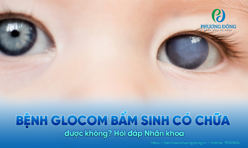 Hỏi đáp Nhãn khoa: Bệnh glocom bẩm sinh có chữa được không?  Hỏi đáp Nhãn khoa: Bệnh glocom bẩm sinh có chữa được không?