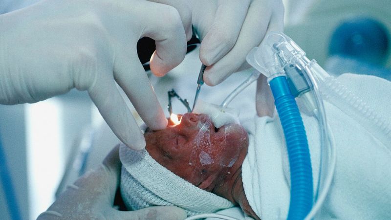 Bệnh nhi có thể sẽ được phẫu thuật để điều trị bệnh