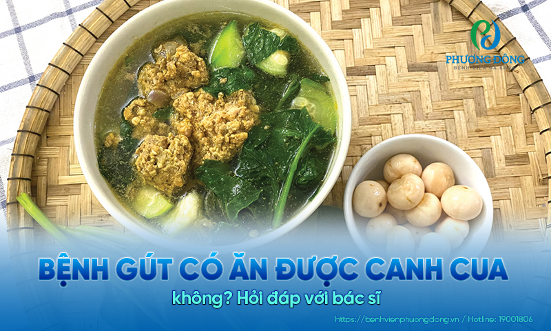 Hỏi đáp Cơ xương khớp: Bệnh gút có ăn được canh cua không?  Hỏi đáp Cơ xương khớp: Bệnh gút có ăn được canh cua không?