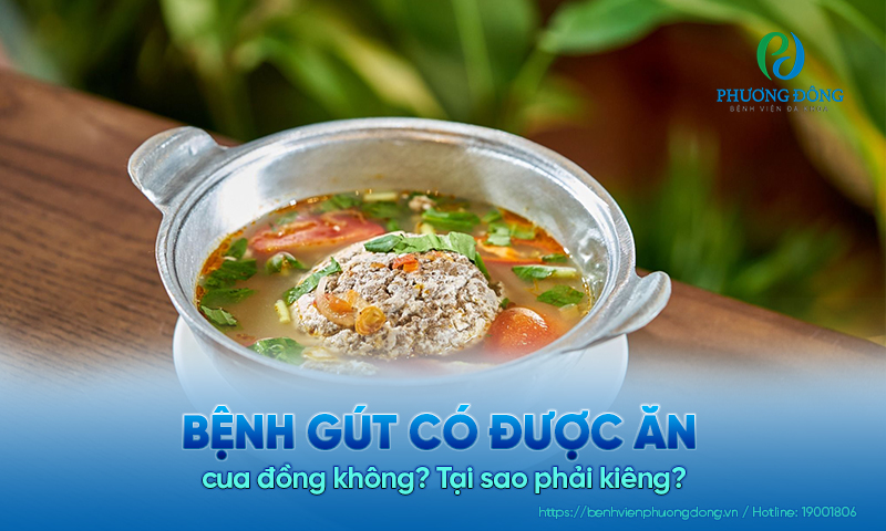 Bệnh gút có được ăn cua đồng không? Tại sao phải kiêng? Bệnh gút có được ăn cua đồng không? Tại sao phải kiêng?