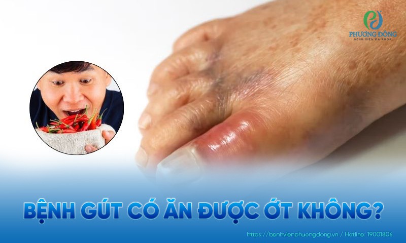 Bệnh gút có ăn được ớt không? Hệ lụy khi tiêu thụ ớt quá mức