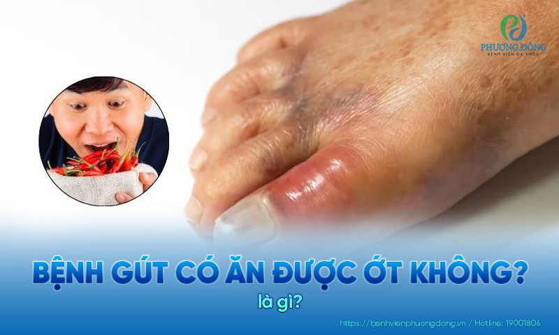 Bệnh gút có ăn được ớt không? Người mắc bệnh gút vẫn có thể ăn ớt