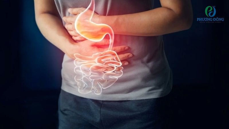 Nguy cơ rối loạn tiêu hoá nếu tiêu thụ quá mức lượng ớt trong ngày
