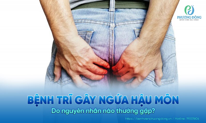 Bệnh trĩ gây ngứa hậu môn do nguyên nhân nào thường gặp?
