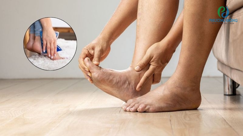 Bị gút có nên chườm đá không? Các bước chườm đá khi bị gút