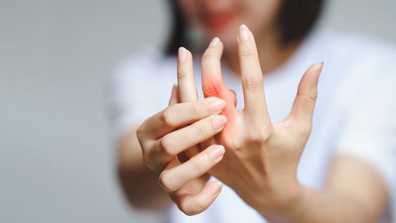 Viêm khớp dạng thấp là bệnh chưa thể chữa khỏi hoàn toàn