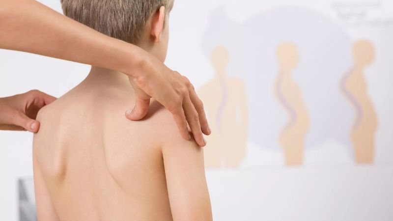 Bạn nên đi gặp bác sĩ nếu cơ lưng đau nhức