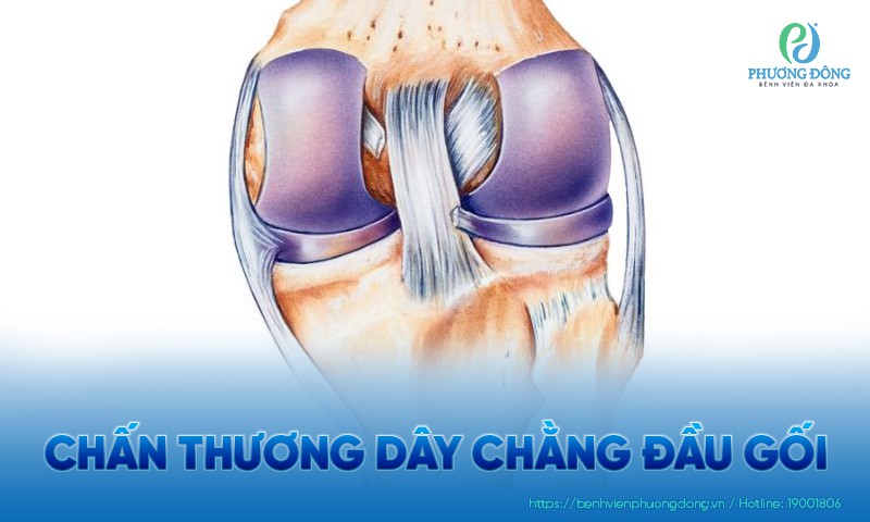 Chấn thương dây chằng đầu gối: Nguyên nhân và hướng điều trị