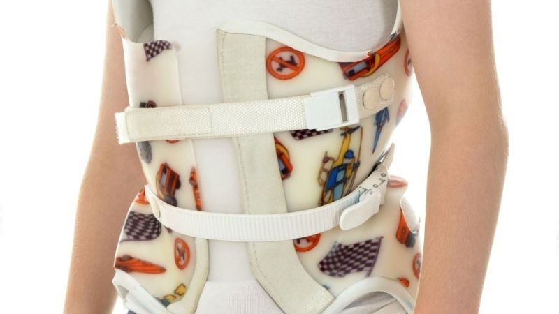 Trong một số trường hợp, bé sẽ được đeo đai định hình