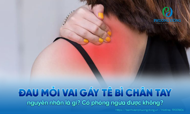 Đau mỏi vai gáy tê bì chân tay nguyên nhân là gì? Có phòng ngừa được không?