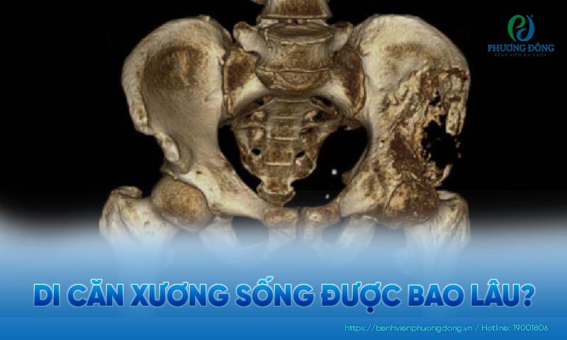 Ung thư di căn xương sống được bao lâu? Phân loại và hướng điều trị