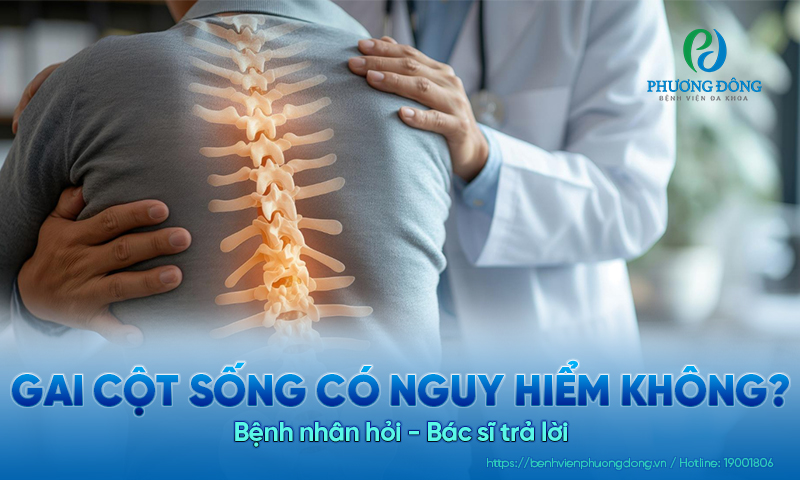 Bệnh nhân hỏi - Bác sĩ trả lời: Gai cột sống lưng có nguy hiểm không?