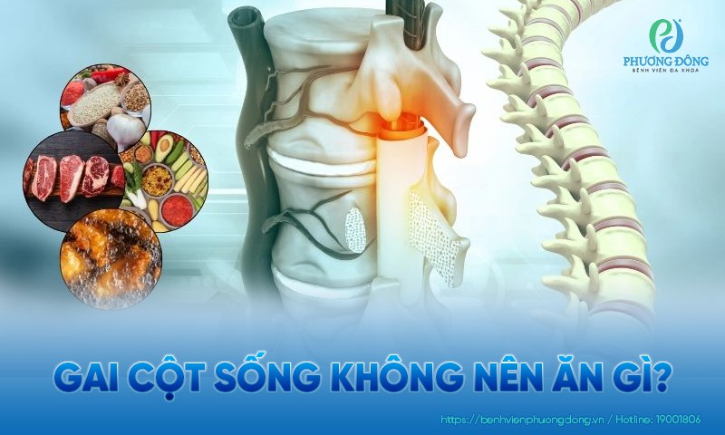 Gai cột sống không nên ăn gì? Những lưu ý khi kiêng khem