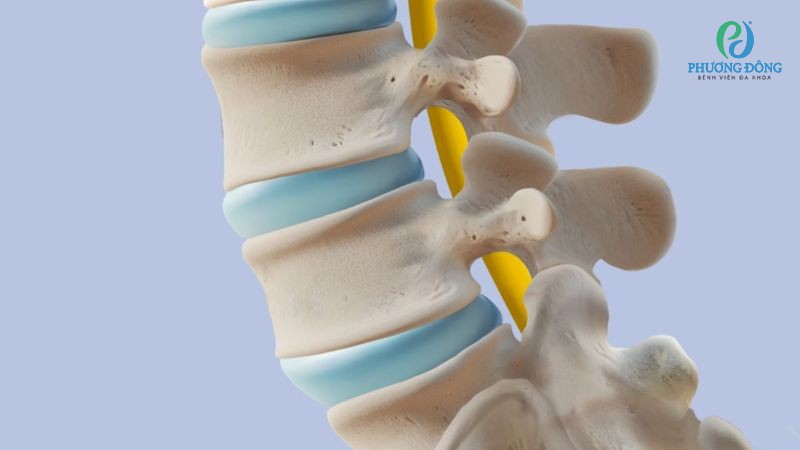Tật nứt cột sống thường xuất hiện ở đốt sống S1 và L5