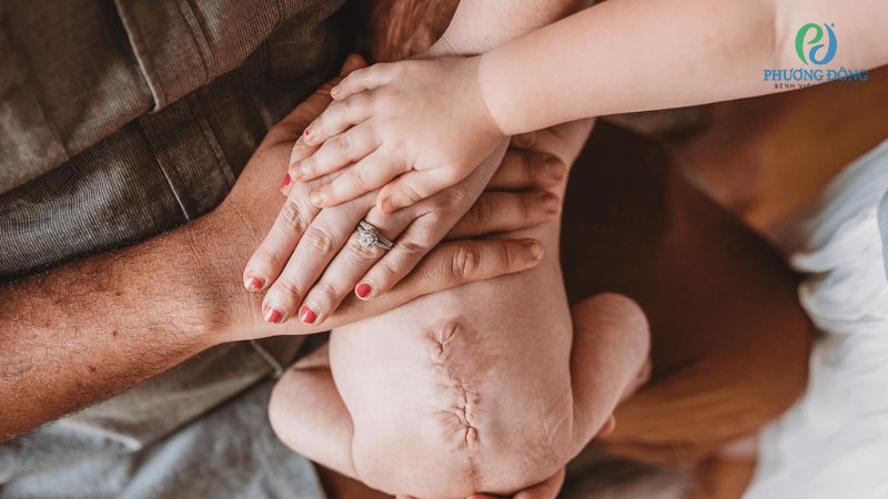 Gai đôi cột sống cần được can thiệp sớm phòng ngừa biến chứng nguy hiểm