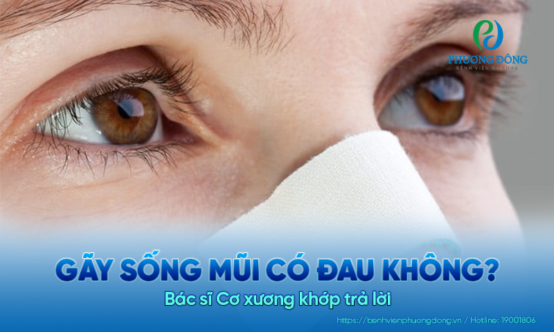 Bác sĩ Cơ xương khớp trả lời: Gãy sống mũi có đau không? Bác sĩ Cơ xương khớp trả lời: Gãy sống mũi có đau không?