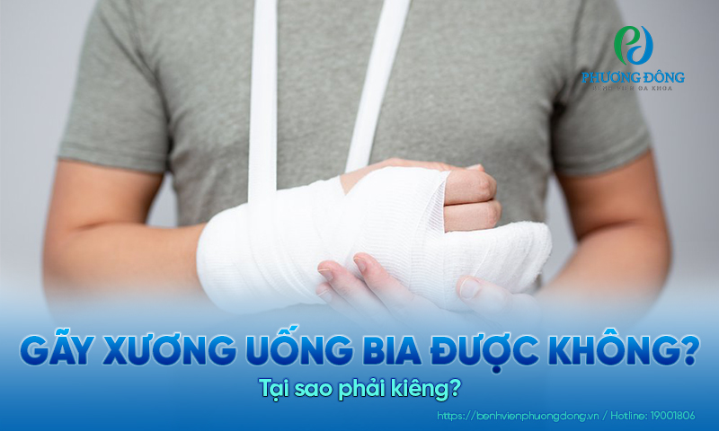 Gãy xương uống bia được không? Tại sao phải kiêng? Gãy xương uống bia được không? Tại sao phải kiêng?