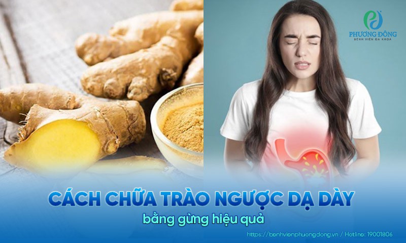 Cách chữa trào ngược dạ dày bằng gừng