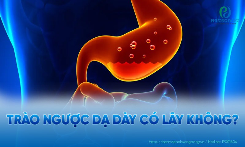 Trào ngược dạ dày có lây không?