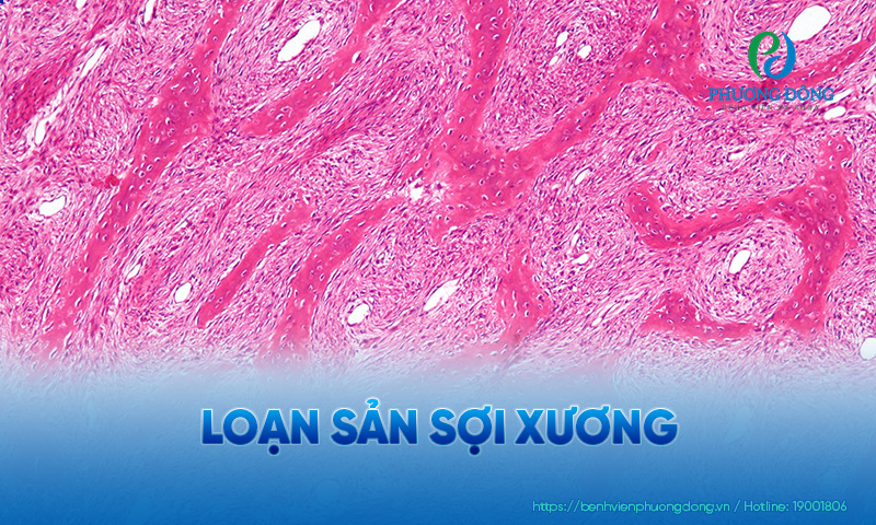 Hình ảnh mẫu bệnh phẩm dưới kính hiển vi