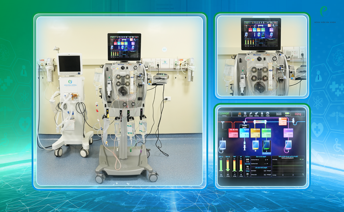 Máy lọc máu liên tục PrisMax đã có mặt tại Phương Đông