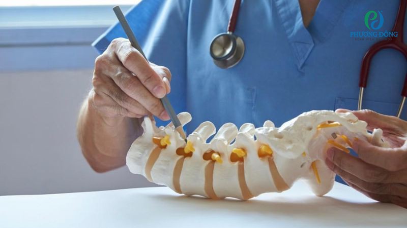 Lưu ý hậu phẫu đối với bệnh nhân gai cột sống