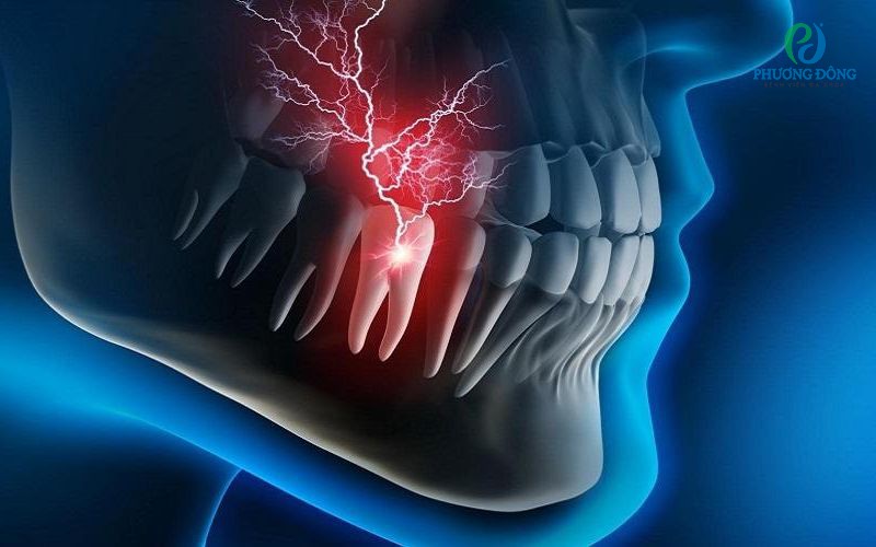 Nhiễm trùng răng miệng: Nguyên nhân, triệu chứng và cách điều trị