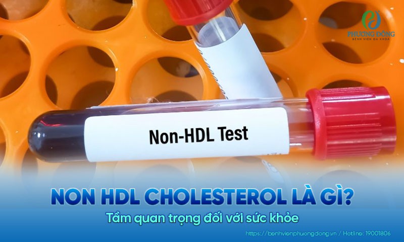 Non HDL cholesterol là gì? Tầm quan trọng đối với sức khỏe