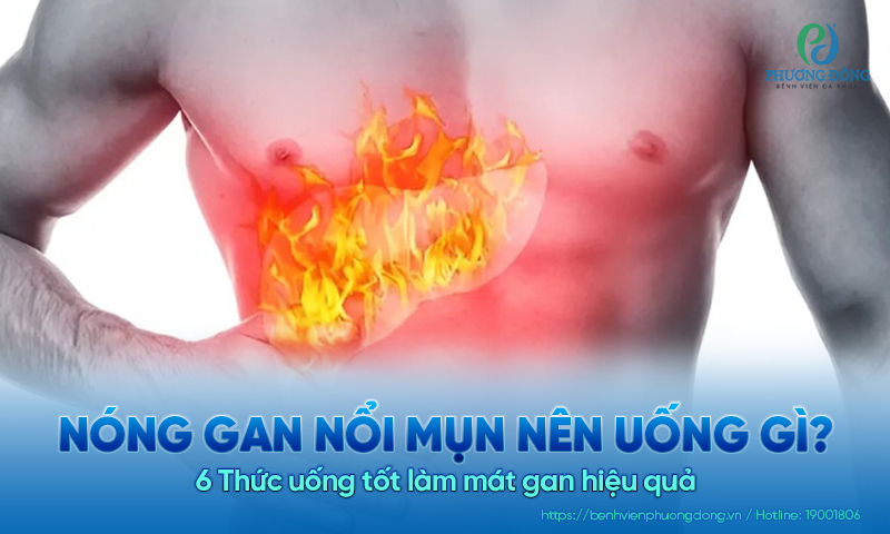 Nóng gan nổi mụn nên uống gì? 6 Thức uống tốt làm mát gan hiệu quả