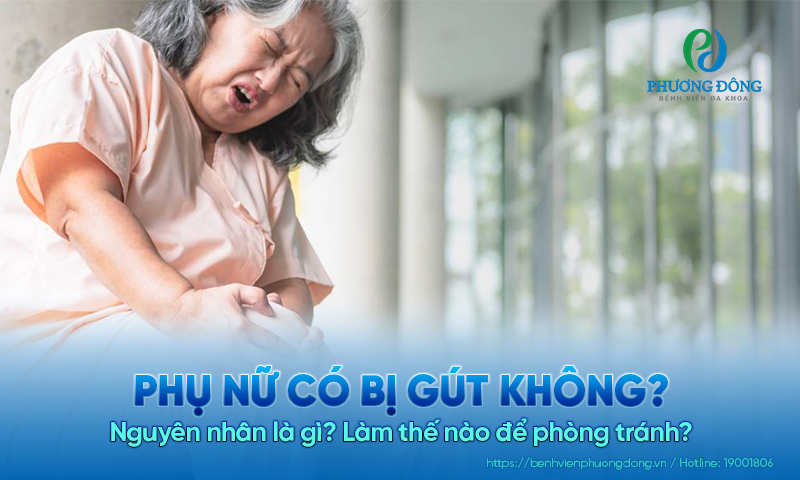Phụ nữ có bị gút không? Nguyên nhân là gì? Làm thế nào để phòng tránh?