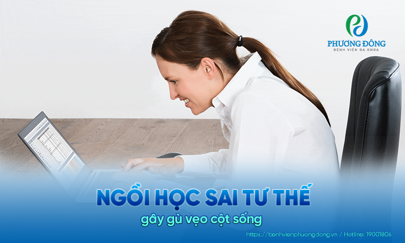 Tư thế ngồi học sai cách theo thời gian có thể khiến cột sống bị gù vẹo