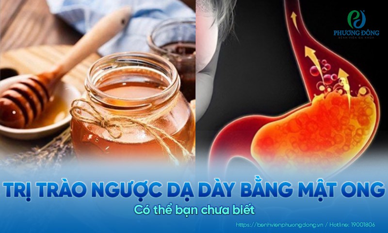 Cách trị trào ngược dạ dày bằng mật ong có thể bạn chưa biết