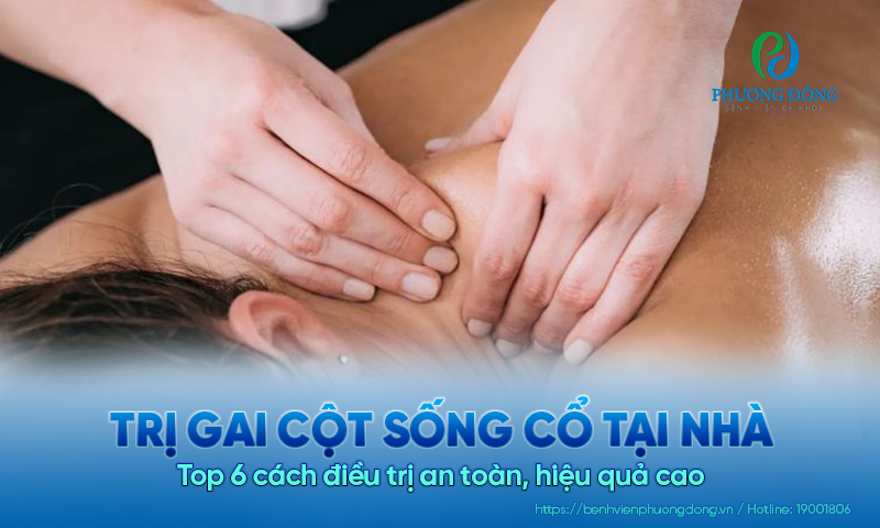 Top 6 cách trị gai cột sống cổ tại nhà an toàn, hiệu quả cao