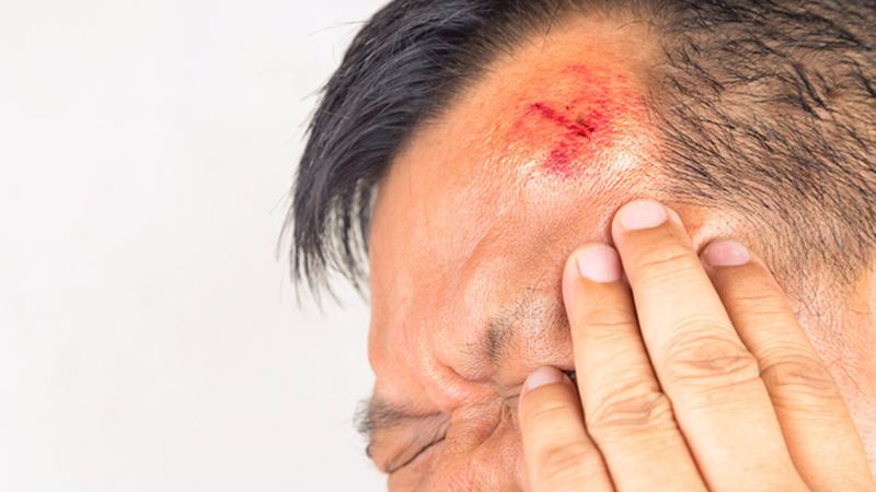 Chấn thương đầu có thể là lý do dẫn đến sự hình thành của các khối u