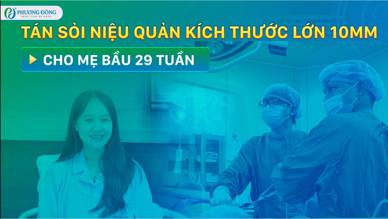 Tán sỏi niệu quản kích thước lớn 10mm cho mẹ bầu 29 tuần