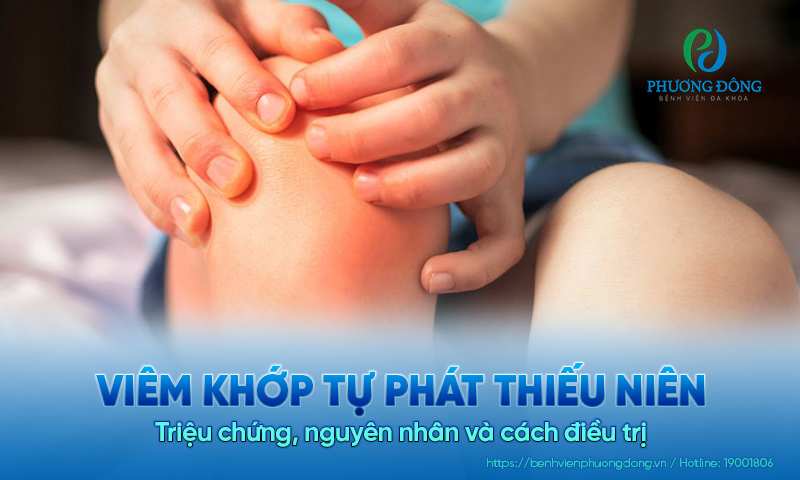 Viêm khớp tự phát thiếu niên: Triệu chứng, nguyên nhân và cách điều trị