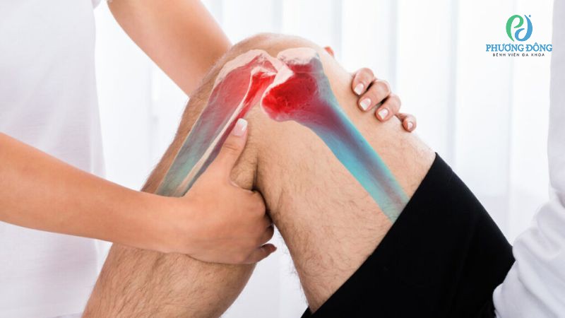 Điều trị tình trạng lồi củ trước xương chày