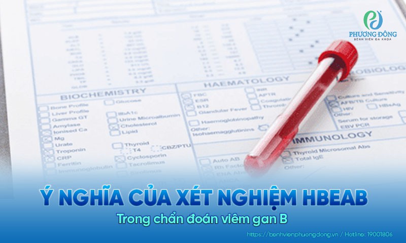Ý nghĩa của xét nghiệm HBeAb trong chẩn đoán viêm gan B