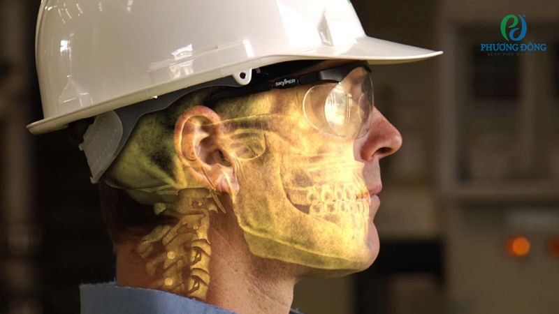 Một số cách bảo vệ xương sọ an toàn