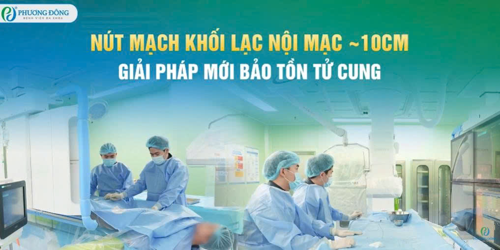 Nút mạch khối lạc nội mạc 10cm - Giải pháp mới bảo tồn tử cung