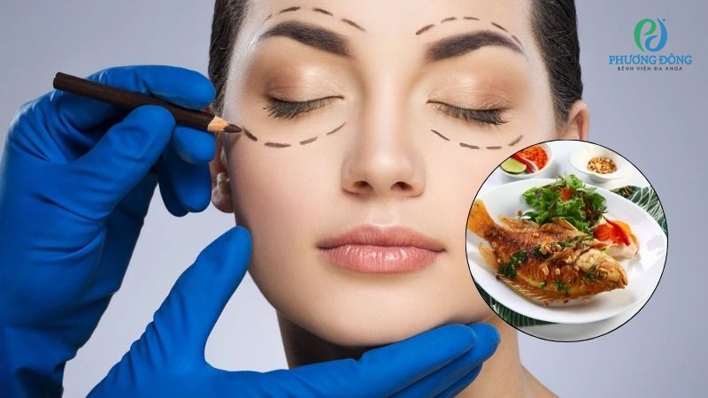 Hỏi đáp chuyên khoa Mắt: Cắt mí mắt ăn cá được không?