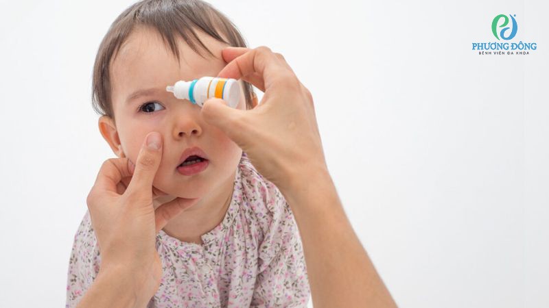 Không nên nhỏ thuốc mắt khi trẻ đang ngủ