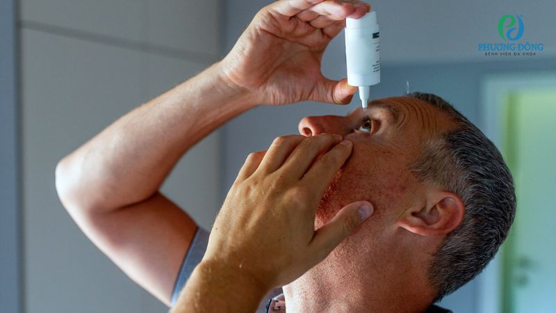 Việc sử dụng thuốc nhỏ mắt nên tuân theo chỉ định, hướng dẫn của bác sĩ chuyên khoa