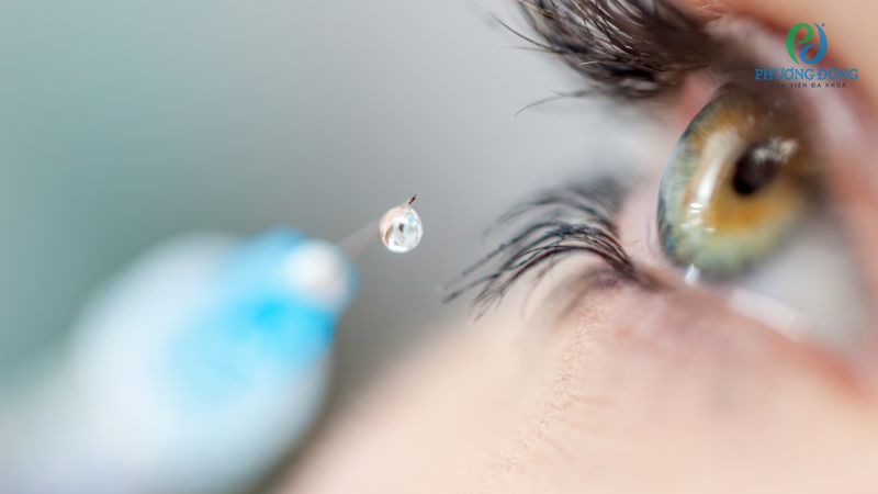 Hỏi đáp chuyên khoa Mắt: Có nên tiêm tan quầng thâm mắt?