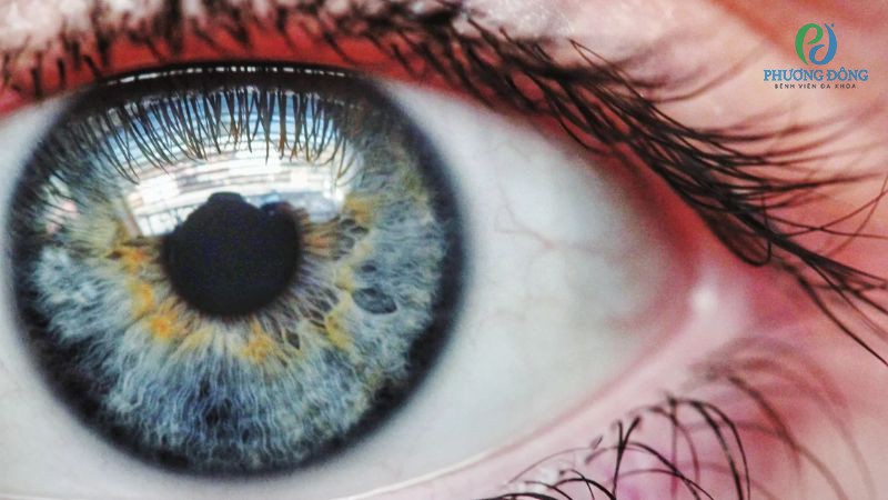 Hỏi đáp chuyên khoa Mắt: Giác mạc có dày lên được không?