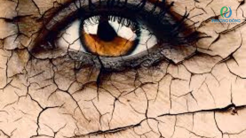 Bác sĩ Nhãn khoa giải đáp: Khô giác mạc có nguy hiểm không?